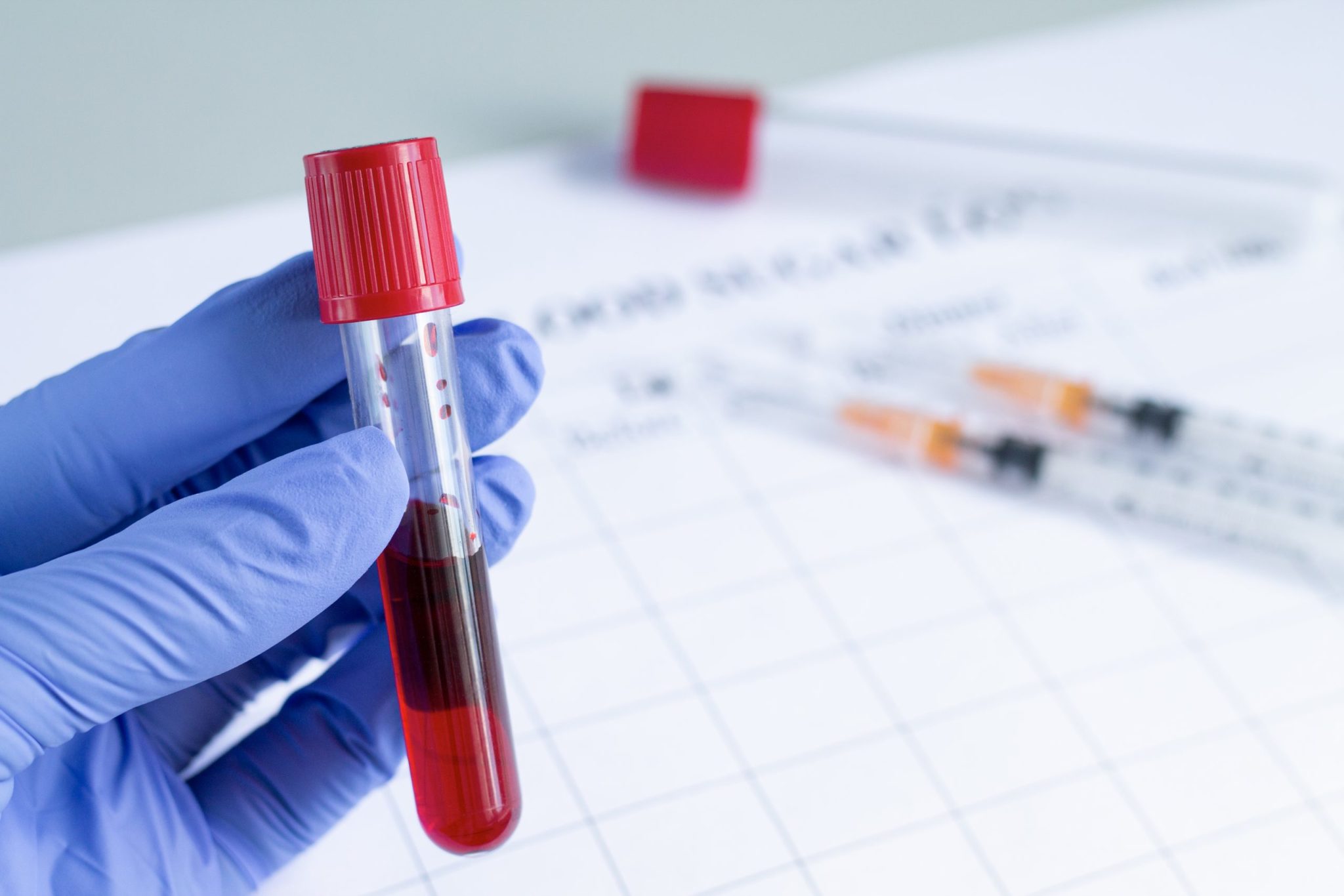 Забота о здоровье: Где провести анализы крови в Москве